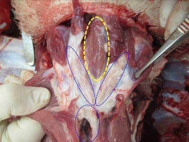  <strong>Рис. 15.</strong> Топографическое расположение органов шеи: щитовидная железа обведена желтым пунктиром, доли тимуса – синим
