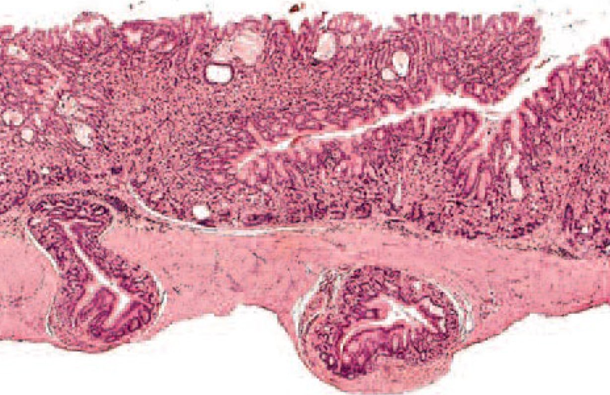  <strong>Рис. 14.</strong> Дивертикулы железистого эпителия у мыши. Хорошо дифференцированный железистый эпителий распространяется в мышечный и серозный слои желудка (2)