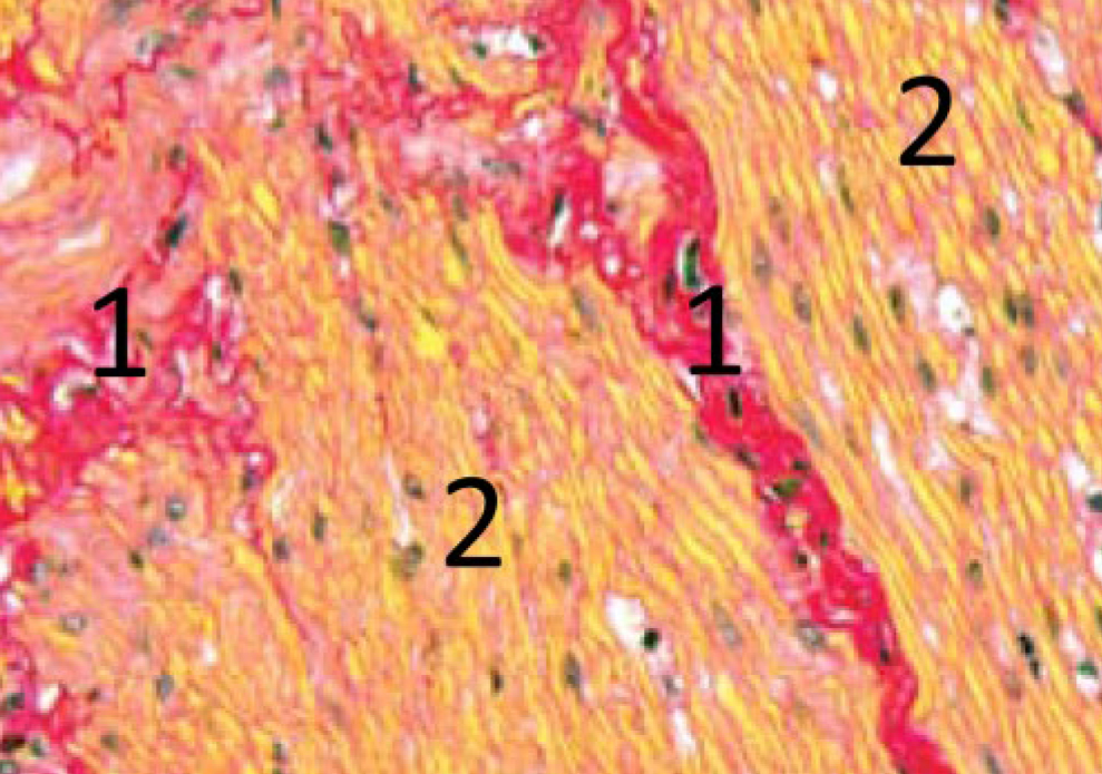  <strong>Рис. 1.</strong> Мышечная оболочка тонкой кишки (13). Окраска по методу Ван Гизона: 1 – соединительная ткань – красная; 2 – мышечная ткань – желтая, ядра – буро-черные 