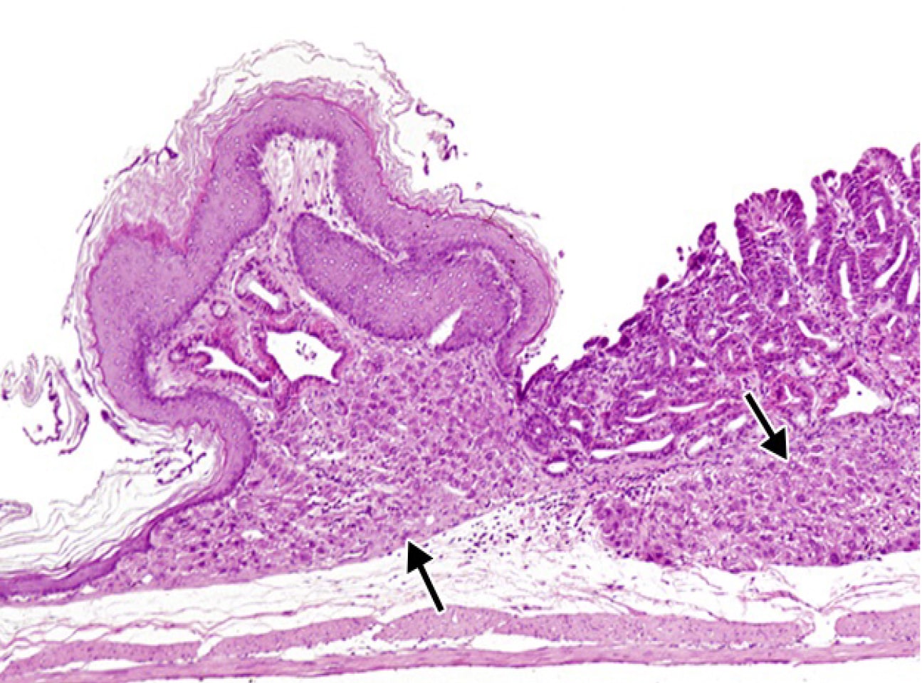  <strong>Рис. 3.</strong> Эктопия по типу гепатоцитов в подслизистом слое желудка вблизи ограничивающего гребня у крысы (10)