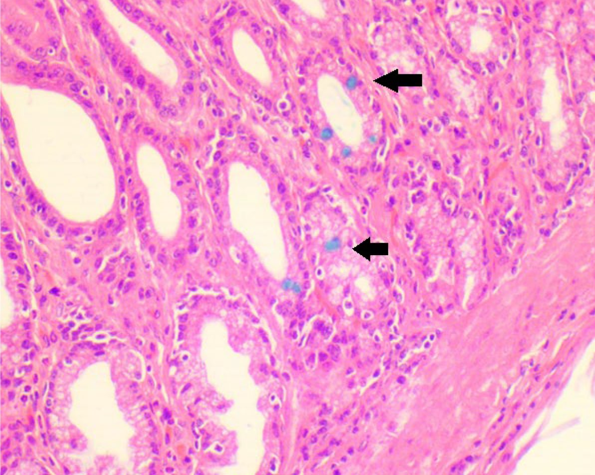  <strong>Рис. 9.</strong> Кишечная метаплазия в железистой части желудка, ассоциированная с хроническим гастритом, у крысы. Окраска гематоксилином и эозином с докраской альциановым синим, ×200