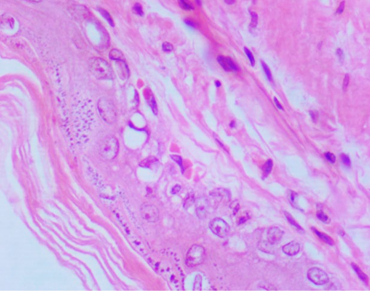  <strong>Рис. 10.</strong> Вакуолизация в безжелезистой части желудка у мыши. Видны крупные вакуоли в эпителиальных клетках. Окраска гематоксилином и эозином, ×400