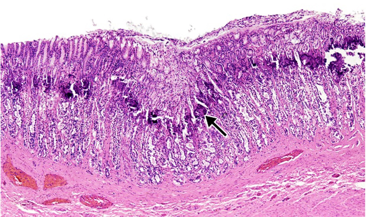 <strong>Рис. 16.</strong> Минерализация эпителия железистой части желудка у крысы. Видны базофильно-окрашенные глыбки и кристаллы (10)